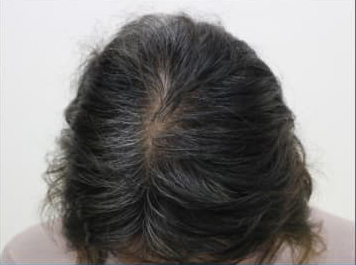 ドクターグロー服用後の写真