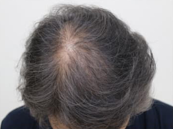 ドグターグロー服用前の写真