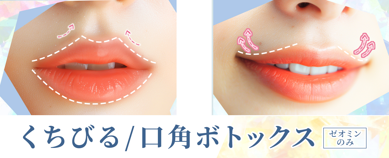 キャンペーンバナー画像