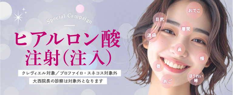 キャンペーンバナー画像