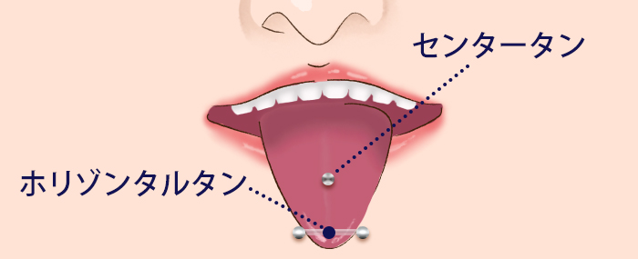 舌ピアスの施術位置